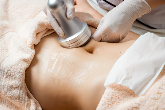 Expert Insights into Body Contouring Procedures